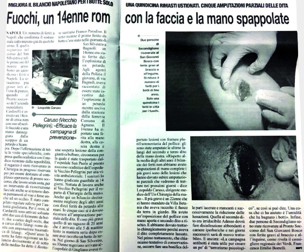 thumbnail of fuochi un 14 rom con la faccia e la mano spappolate 02-01-18